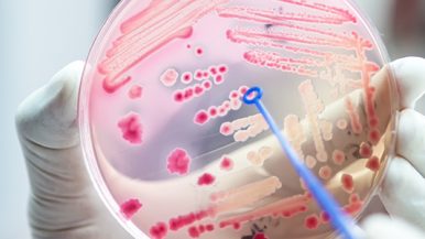 Mano sosteniendo placa de petri con hongos rosas. Portada del curso de microbiología clínica online.